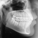 Radiologia Odontológica em Olinda